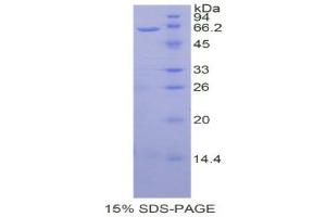 SDS-PAGE (SDS) image for Wingless-Type MMTV Integration Site Family, Member 5A (WNT5A) (AA 62-380) protein (His tag) (ABIN1877848)