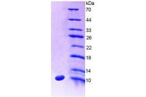 SDS-PAGE analysis of Human SLC30A8 Protein.