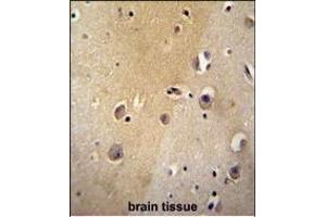 Immunohistochemistry (Paraffin-embedded Sections) (IHC (p)) image for anti-Myosin Regulatory Light Chain Interacting Protein (MYLIP) (AA 111-139) antibody (ABIN651508)