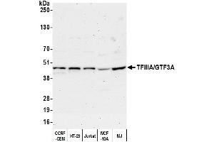 anti-General Transcription Factor IIIA (GTF3A) (AA 1-50) antibody