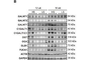 Upregulation of glycogene expression in the LV of DS hypertensive rats. (GLB1 antibody)