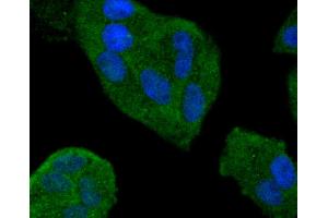 Hela cells were stained with Smad4 (3A1) Monoclonal Antibody  at [1:200] incubated overnight at 4C followed by secondary antibody incubation, DAPI staining of the nuclei and detection. (SMAD4 antibody)