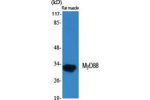 Western Blot (WB) analysis of specific cells using MyD88 Polyclonal Antibody. (MYD88 antibody  (Internal Region))