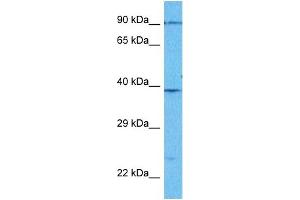Host:  Rabbit  Target Name:  PLMN  Sample Type:  Jurkat Whole Cell lysates  Antibody Dilution:  1. (PLG antibody  (Middle Region))