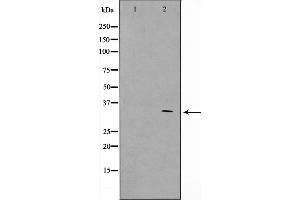 Western blot analysis on HeLa cell lysate using GFRA4 Antibody，The lane on the left is treated with the antigen-specific peptide. (GFRA4 antibody  (Internal Region))