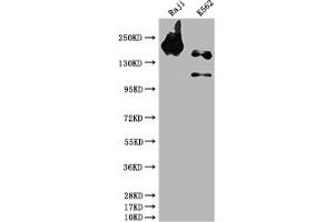 Western Blot Positive WB detected in: Raji whole cell lysate, K562 whole cell lysate All lanes: INPP5D antibody at 1:1500 Secondary Goat polyclonal to rabbit IgG at 1/50000 dilution Predicted band size: 134, 110 kDa Observed band size: 145 kDa (Recombinant INPP5D antibody)