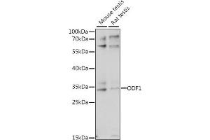 Western blot analysis of extracts of various cell lines, using ODF1 antibody (ABIN7269127) at 1:1000 dilution. (ODF1 antibody  (AA 80-180))