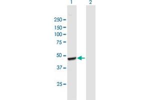 Western Blot analysis of AACS expression in transfected 293T cell line by AACS MaxPab polyclonal antibody.