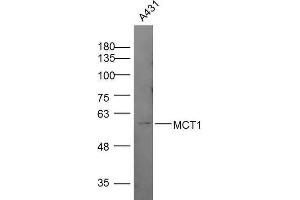 Lane 1: A431 lysates, probed with MCT1 Polyclonal Antibody, Unconjugated  at 1:300 overnight at 4˚C. (MCTS1 antibody  (AA 251-350))