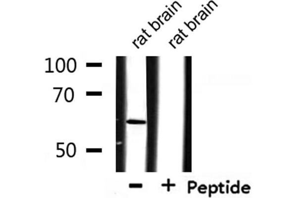 CSTF2 antibody  (N-Term)