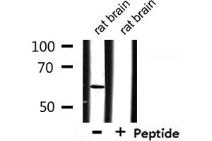 Western blot analysis of extracts from rat brain, using CSTF2 Antibody.