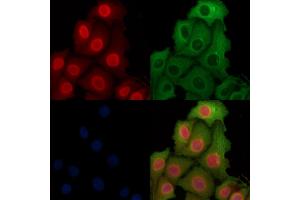 ABIN6262398 and ABIN6269012 staining Hela cells by IF/ICC. (HSP70 antibody  (C-Term))