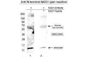 Western blot using  affinity purified anti-NAG-1/GDF15 (N-terminal specific) antibody shows detection of a 14 kDa band corresponding to recombinant human NAG-1 purified from CHO cells. (GDF15 antibody  (N-Term))
