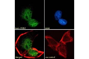 (ABIN184909) Immunofluorescence analysis of paraformaldehyde fixed U2OS cells, permeabilized with 0. (CECR2 antibody  (C-Term))