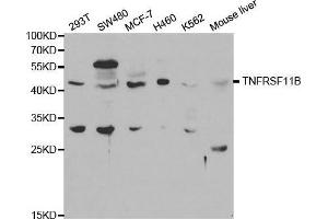 Western blot analysis of extracts of various cell lines, using TNFRSF11B antibody. (Osteoprotegerin antibody  (AA 22-280))