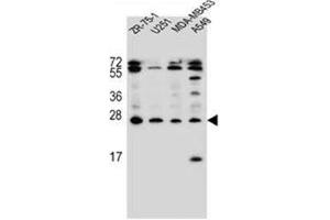 Western blot analysis of Endothelin-1 Antibody (C-term) in ZR-75-1, U251, MDA-MB453, A549 cell line lysates (35ug/lane).
