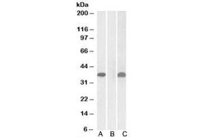 Western blot testing of HEK293 lysate overexpressing human PIM2-MYC with PIM2 antibody (1ug/ml) in Lane A and anti-MYC (1/1000) in lane C. (PIM2 antibody)