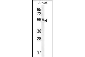 TRIM59 Antibody (N-term) (ABIN655580 and ABIN2845072) western blot analysis in Jurkat cell line lysates (35 μg/lane). (TRIM59 antibody  (N-Term))