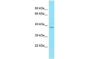 Western Blotting (WB) image for anti-Zygote Arrest 1-Like (ZAR1L) (C-Term) antibody (ABIN2791461) (ZAR1L antibody  (C-Term))