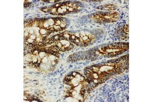 Anti-beta Catenin antibody, IHC(F) IHC(F): Rat Intestine Tissue (CTNNB1 antibody  (C-Term))