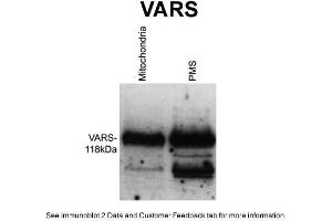 WB Suggested Anti-VARS Antibody Titration: 1 ug/mlPositive Control: Wildtype Neurospora crassa (VARS antibody  (Middle Region))