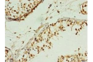 Immunohistochemistry of paraffin-embedded human testis tissue using ABIN7165811 at dilution of 1:100 (MIS12 antibody  (AA 1-305))