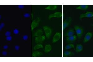 Detection of AMH in Human Hela cell using Monoclonal Antibody to Anti-Mullerian Hormone (AMH) (AMH antibody  (AA 19-560))