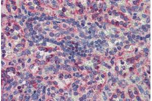 Spleen, Human: Formalin-Fixed, Paraffin-Embedded (FFPE) (MKNK2 antibody  (AA 36-85))