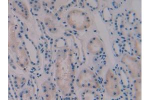 IHC-P analysis of Human Kidney Tissue, with DAB staining. (Vip antibody  (AA 29-165))