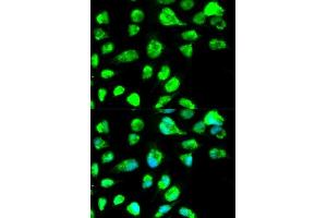 Immunofluorescence analysis of MCF-7 cells using LIG3 antibody. (LIG3 antibody)