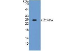 Detection of Recombinant PTGS2, Human using Polyclonal Antibody to Cyclooxygenase-2 (COX 2)