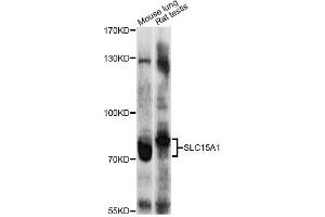 Western blot analysis of extracts of various cell lines, using SLC15A1 antibody (ABIN4905175) at 1:1000 dilution. (SLC15A1 antibody)