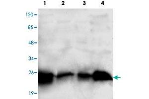 Western blot analysis of RAB2A monoclonal antibody  at 1:1000 dilution. (RAB2A antibody  (C-Term))