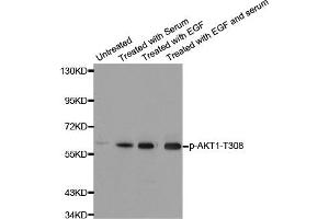 Western Blotting (WB) image for anti-V-Akt Murine Thymoma Viral Oncogene Homolog 1 (AKT1) (pThr308) antibody (ABIN1869972) (AKT1 antibody  (pThr308))