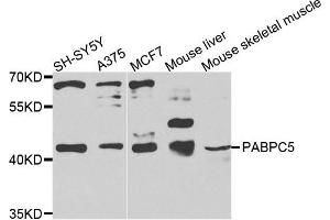 Western blot analysis of extracts of various cells, using PABPC5 antibody.