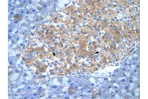 Image no. 1 for anti-Protein Inhibitor of Activated STAT, 2 (PIAS2) (C-Term) antibody (ABIN6736323) (PIAS2 antibody  (C-Term))