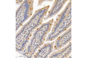 Immunohistochemistry of paraffin embedded mouse small intestine using PTPN3 (ABIN7075298) at dilution of 1:700 (300x lens) (PTPN3 antibody)