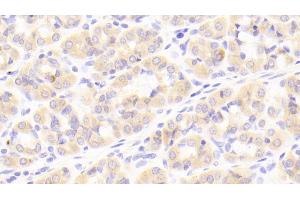 Immunohistochemistry (IHC) image for anti-Nuclear Factor of kappa Light Polypeptide Gene Enhancer in B-Cells Inhibitor, alpha (NFKBIA) (AA 74-247) antibody (ABIN7434194)