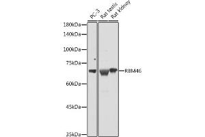 Western blot analysis of extracts of various cell lines, using RBM46 antibody (ABIN7270086) at 1:1000 dilution. (RBM46 antibody  (AA 1-140))
