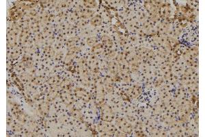 ABIN6277711 at 1/100 staining Mouse kidney tissue by IHC-P. (TAB1 antibody  (C-Term))