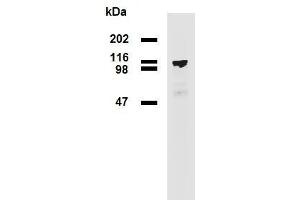 Western blotting analysis (reducing conditions) of PDE8a in HEK293T/17-PDE8a transfectants using mouse monoclonal antibody EM-52 .