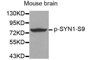Western blot analysis of extracts from mouse Brain tissue using Phospho-SYN1-S9 antibody (ABIN2987713). (SYN1 antibody  (pSer9))