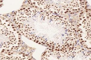 Immunohistochemistry analysis of paraffin-embedded mouse testis using,PPIL2 (ABIN7075005) at dilution of 1: 3600 (PPIL2 antibody)