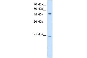 BLK antibody used at 2. (BLK antibody  (Middle Region))