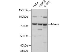 Western blot analysis of extracts of various cell lines, using Menin antibody (ABIN7268698) at 1:1000 dilution. (Menin antibody  (AA 266-615))