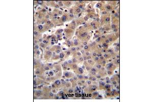 GUSB Antibody (C-term) (ABIN656383 and ABIN2845678) immunohistochemistry analysis in formalin fixed and paraffin embedded human liver tissue followed by peroxidase conjugation of the secondary antibody and DAB staining.