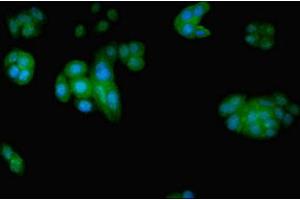 Immunofluorescent analysis of PC-3 cells using ABIN7152209 at dilution of 1:100 and Alexa Fluor 488-congugated AffiniPure Goat Anti-Rabbit IgG(H+L) (EIF5 antibody  (AA 1-431))