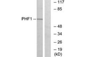 Western blot analysis of extracts from HeLa cells, using PHF1 Antibody.