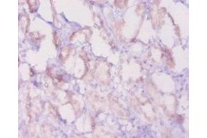 Immunohistochemistry of paraffin-embedded human kidney tissue using ABIN7176964 at dilution of 1:20 (Bcl-2 antibody  (AA 5-205))