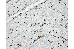 Immunohistochemical staining of paraffin-embedded Kidney tissue using anti-ERCC1 mouse monoclonal antibody. (ERCC1 antibody)